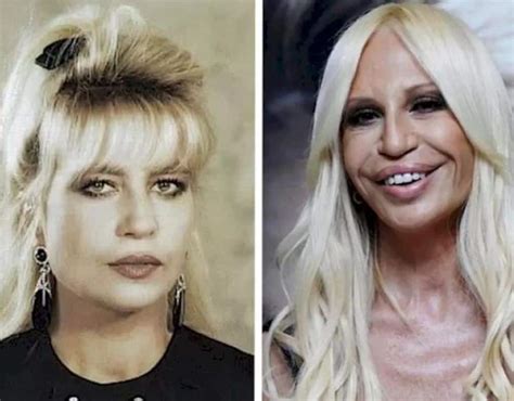 donatrlla versace|donatella versace face what happened.